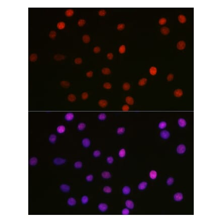 Immunofluorescence - Anti-HMGB1 (acetyl Lys29) Antibody (A93032) - Antibodies.com