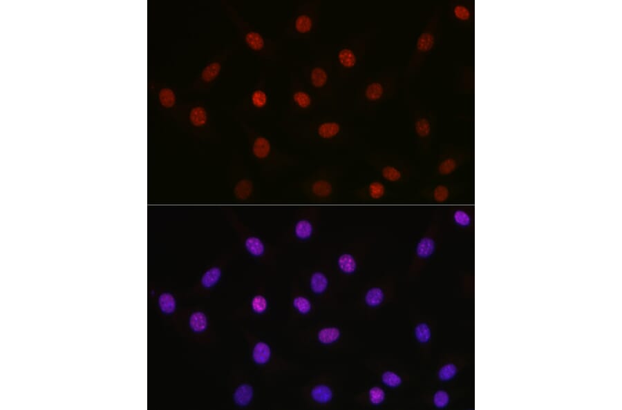 Immunofluorescence - Anti-HMGB1 (acetyl Lys29) Antibody (A93032) - Antibodies.com