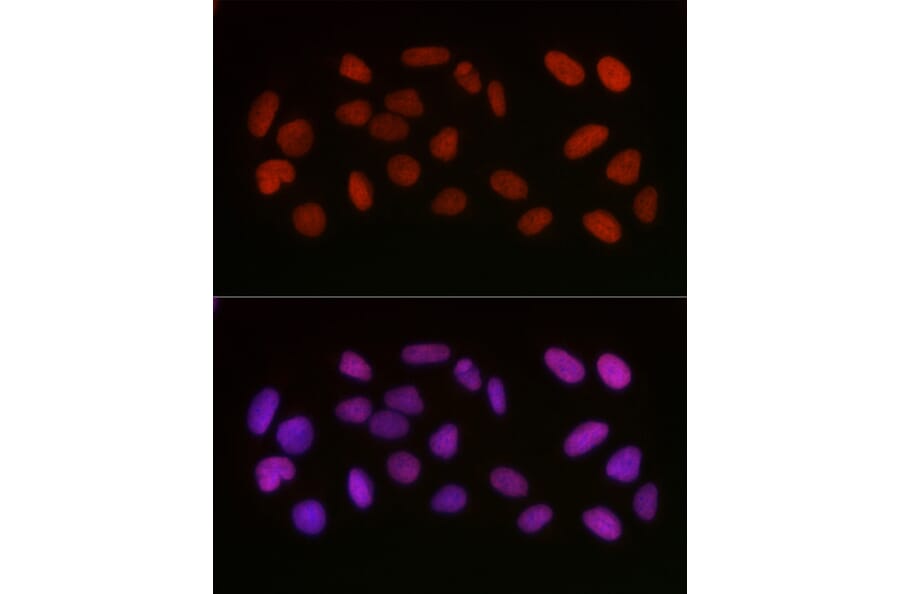 Immunofluorescence - Anti-HMGB1 (acetyl Lys29) Antibody (A93032) - Antibodies.com