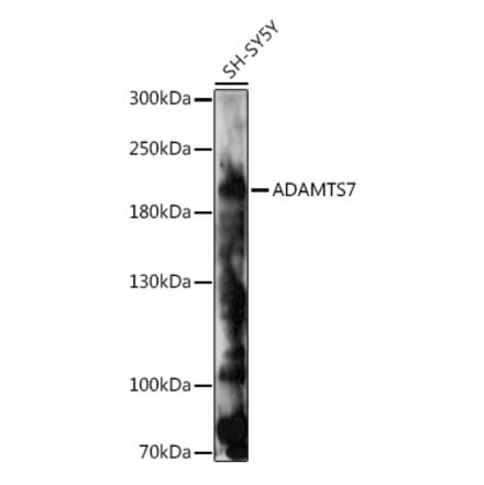 Western Blot - Anti-ADAMTS7 Antibody (A93034) - Antibodies.com