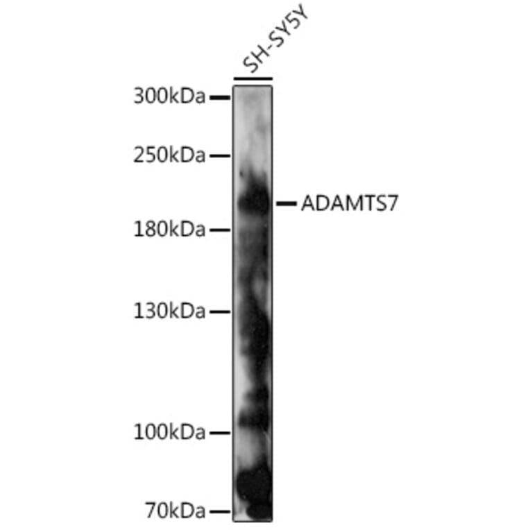 Western Blot - Anti-ADAMTS7 Antibody (A93034) - Antibodies.com