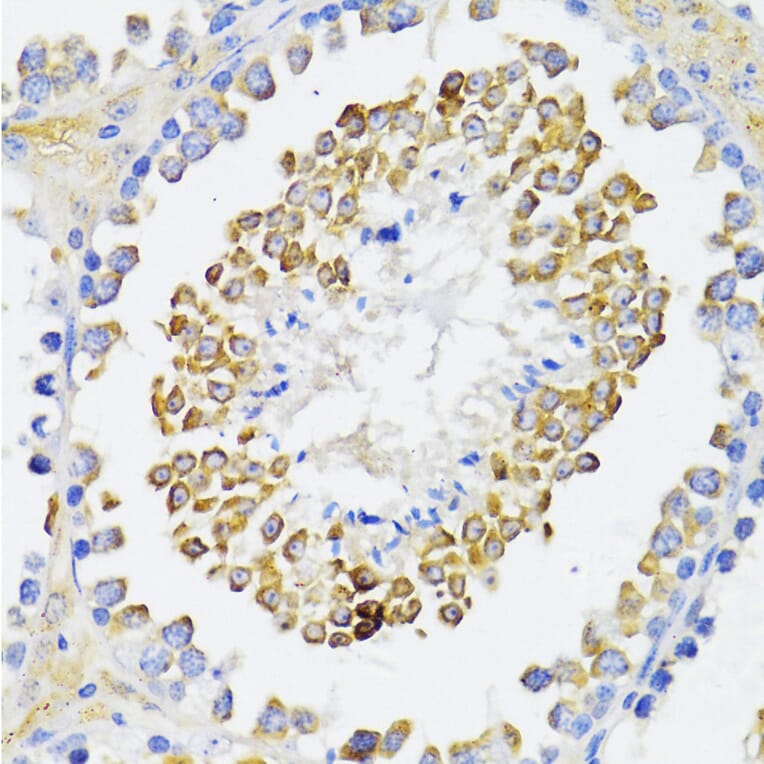 Immunohistochemistry - Anti-Beta Arrestin 2 Antibody (A93037) - Antibodies.com