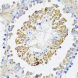 Immunohistochemistry - Anti-Beta Arrestin 2 Antibody (A93037) - Antibodies.com