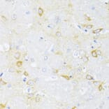 Immunohistochemistry - Anti-Beta Arrestin 2 Antibody (A93037) - Antibodies.com