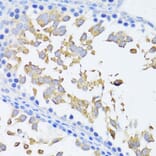 Immunohistochemistry - Anti-Beta Arrestin 2 Antibody (A93037) - Antibodies.com
