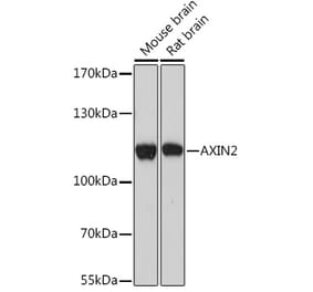 Western Blot - Anti-Axin 2 Antibody (A93038) - Antibodies.com