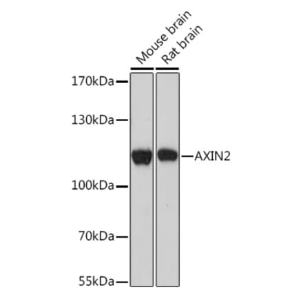 Western Blot - Anti-Axin 2 Antibody (A93038) - Antibodies.com