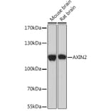 Western Blot - Anti-Axin 2 Antibody (A93038) - Antibodies.com
