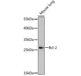 Western Blot - Anti-Bcl-2 Antibody (A93039) - Antibodies.com