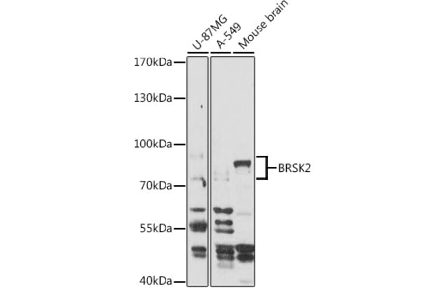 Western Blot - Anti-BRSK2 Antibody (A93040) - Antibodies.com