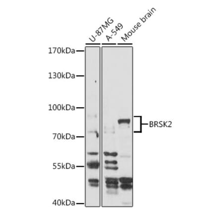 Western Blot - Anti-BRSK2 Antibody (A93040) - Antibodies.com