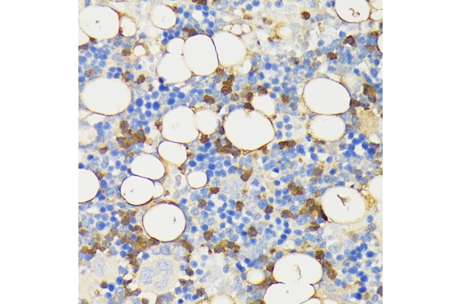 Immunohistochemistry - Anti-Cathelicidin / CLP Antibody (A93041) - Antibodies.com