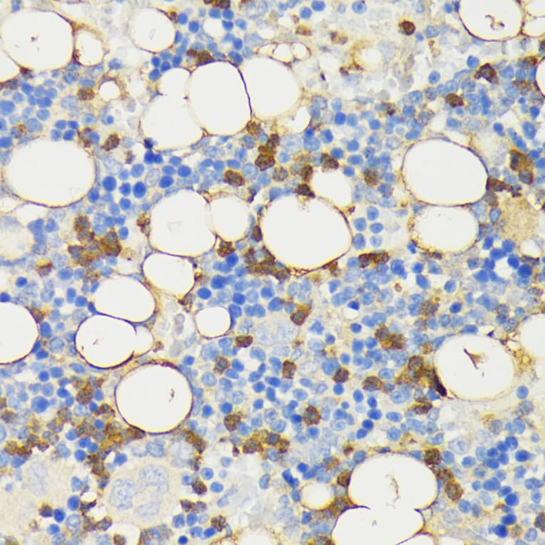 Immunohistochemistry - Anti-Cathelicidin / CLP Antibody (A93041) - Antibodies.com