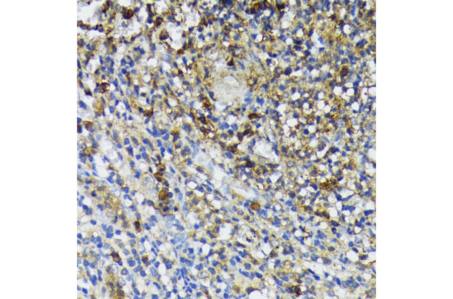 Immunohistochemistry - Anti-Cathelicidin / CLP Antibody (A93041) - Antibodies.com