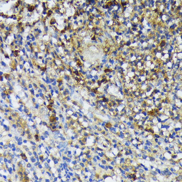 Immunohistochemistry - Anti-Cathelicidin / CLP Antibody (A93041) - Antibodies.com