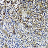 Immunohistochemistry - Anti-Cathelicidin / CLP Antibody (A93041) - Antibodies.com