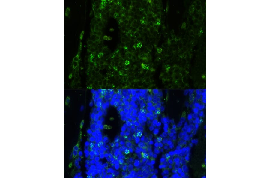 Immunofluorescence - Anti-Cathelicidin / CLP Antibody (A93041) - Antibodies.com