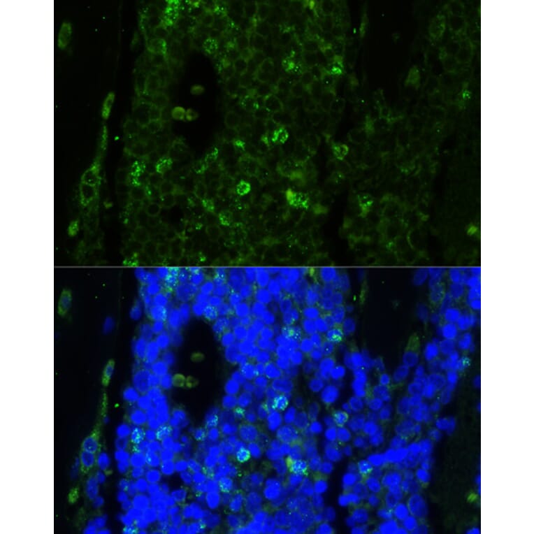 Immunofluorescence - Anti-Cathelicidin / CLP Antibody (A93041) - Antibodies.com