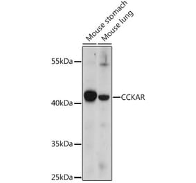 Western Blot - Anti-CCK1-R Antibody (A93043) - Antibodies.com