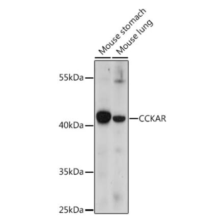 Western Blot - Anti-CCK1-R Antibody (A93043) - Antibodies.com