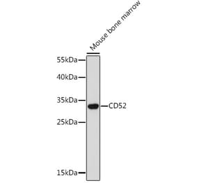 Western Blot - Anti-CD52 Antibody (A93046) - Antibodies.com
