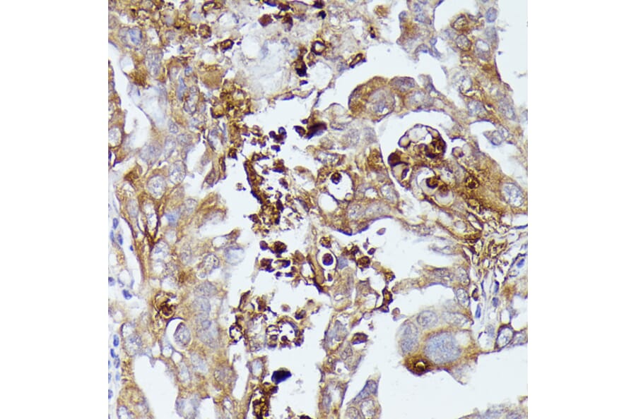 Immunohistochemistry - Anti-CD52 Antibody (A93046) - Antibodies.com