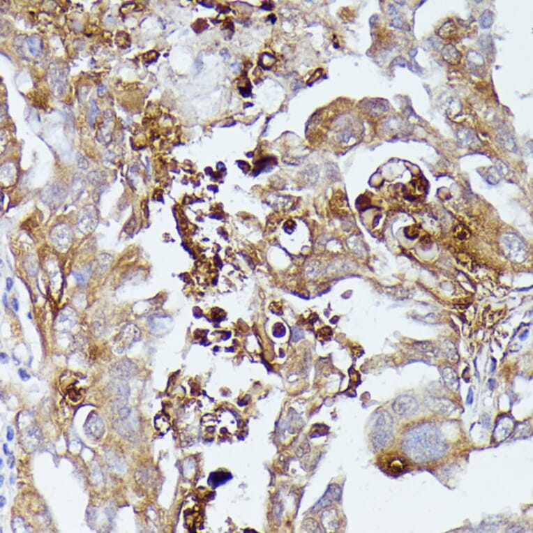 Immunohistochemistry - Anti-CD52 Antibody (A93046) - Antibodies.com