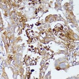 Immunohistochemistry - Anti-CD52 Antibody (A93046) - Antibodies.com