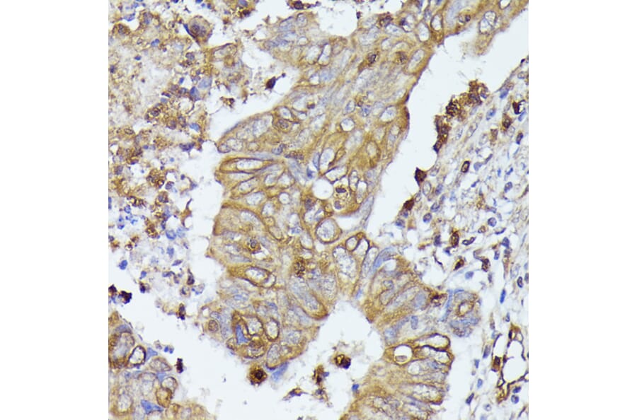 Immunohistochemistry - Anti-CD52 Antibody (A93046) - Antibodies.com