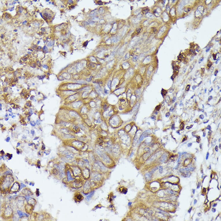 Immunohistochemistry - Anti-CD52 Antibody (A93046) - Antibodies.com