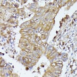 Immunohistochemistry - Anti-CD52 Antibody (A93046) - Antibodies.com