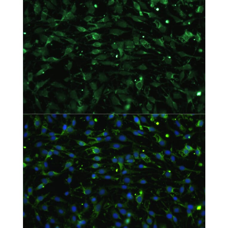 Immunofluorescence - Anti-CHRM1 Antibody (A93050) - Antibodies.com