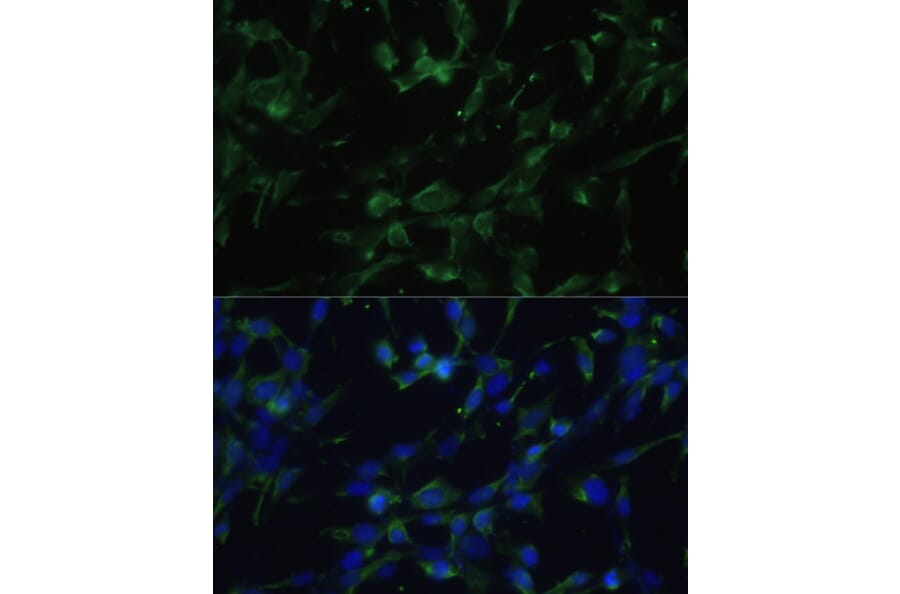 Immunofluorescence - Anti-CHRM1 Antibody (A93050) - Antibodies.com