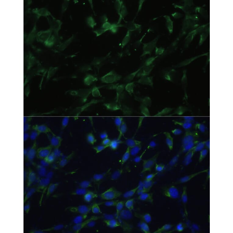 Immunofluorescence - Anti-CHRM1 Antibody (A93050) - Antibodies.com