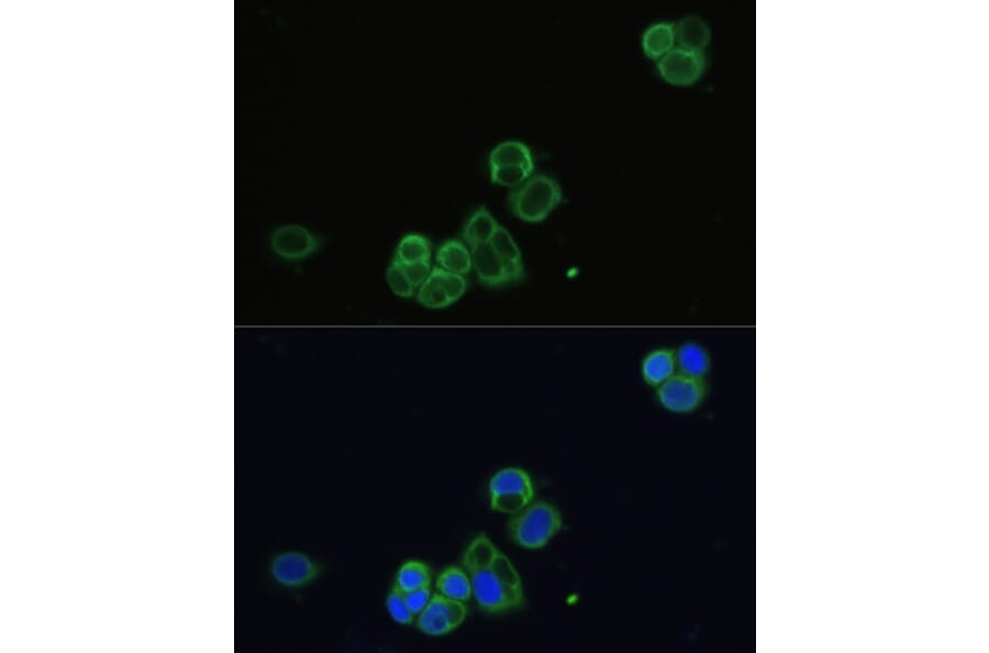 Immunofluorescence - Anti-CHRM1 Antibody (A93050) - Antibodies.com