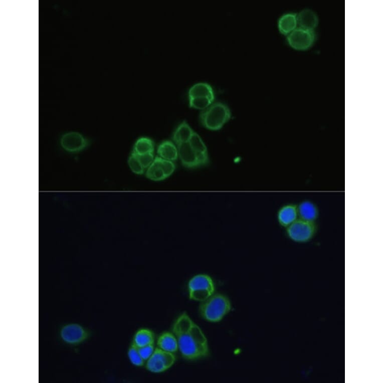Immunofluorescence - Anti-CHRM1 Antibody (A93050) - Antibodies.com