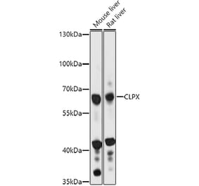 Western Blot - Anti-CLPX Antibody (A93051) - Antibodies.com