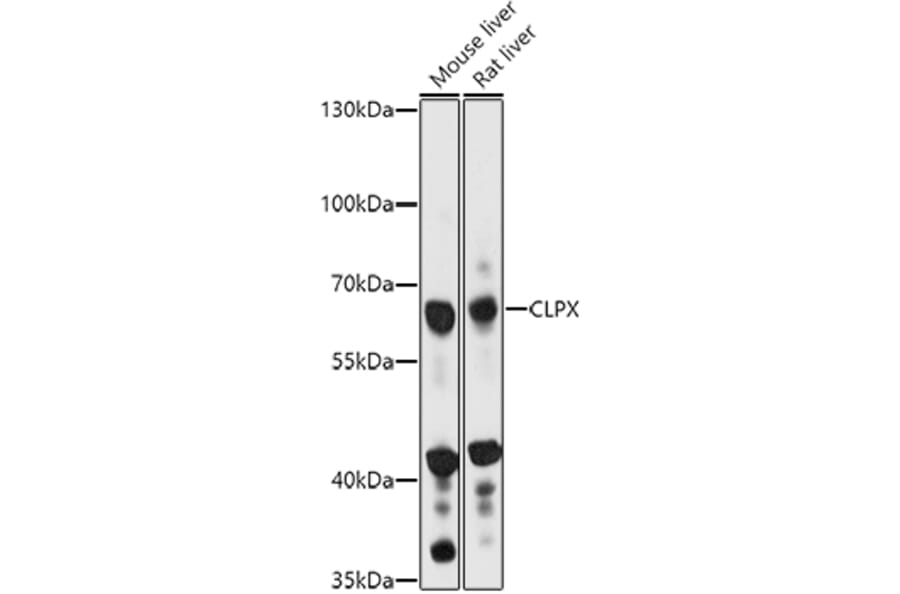 Western Blot - Anti-CLPX Antibody (A93051) - Antibodies.com
