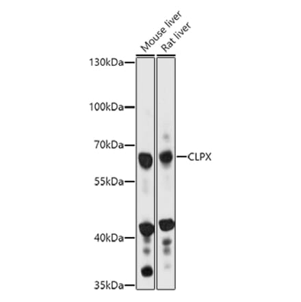 Western Blot - Anti-CLPX Antibody (A93051) - Antibodies.com