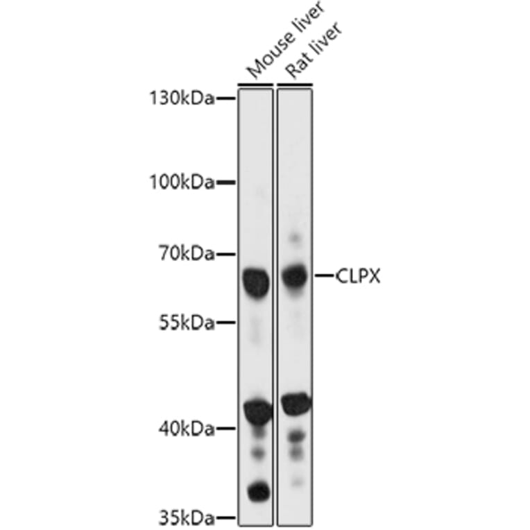 Western Blot - Anti-CLPX Antibody (A93051) - Antibodies.com