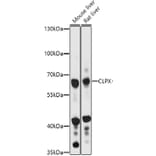 Western Blot - Anti-CLPX Antibody (A93051) - Antibodies.com