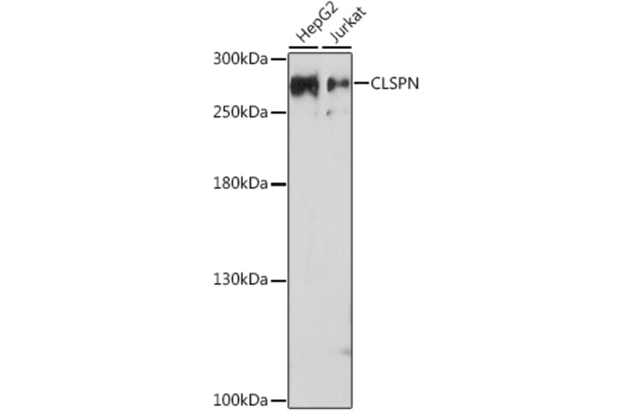 Western Blot - Anti-Claspin Antibody (A93052) - Antibodies.com