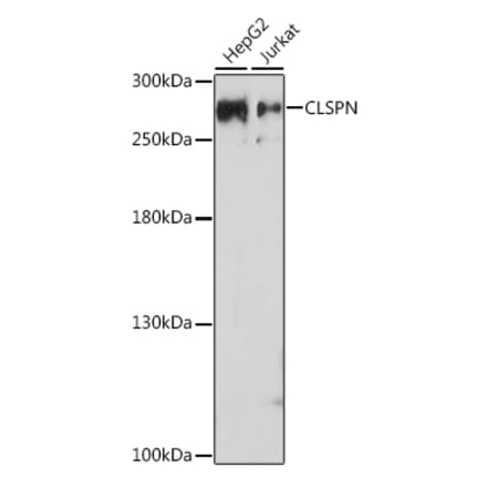 Western Blot - Anti-Claspin Antibody (A93052) - Antibodies.com