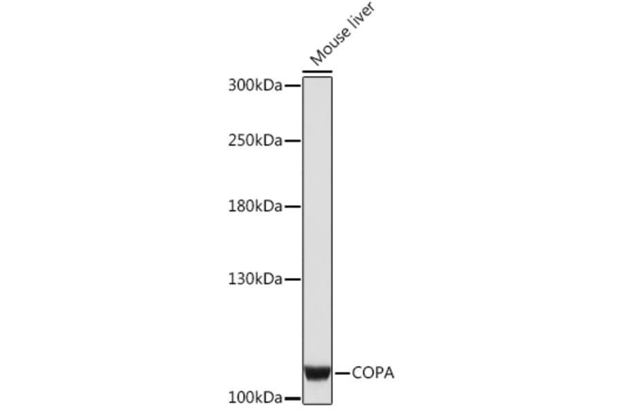 Western Blot - Anti-alpha COP I/COPA Antibody (A93053) - Antibodies.com