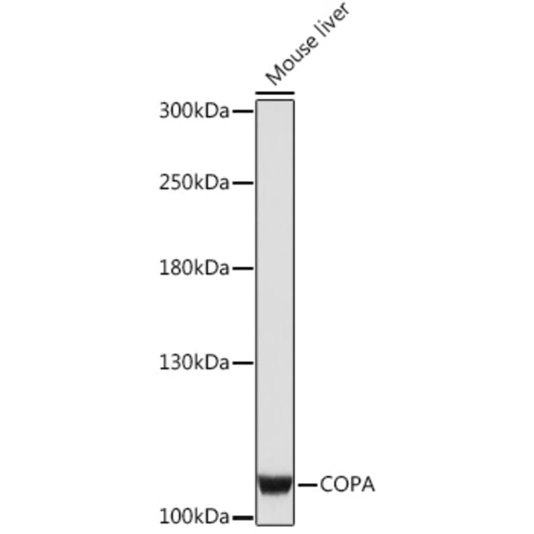 Western Blot - Anti-alpha COP I/COPA Antibody (A93053) - Antibodies.com