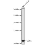 Western Blot - Anti-alpha COP I/COPA Antibody (A93053) - Antibodies.com