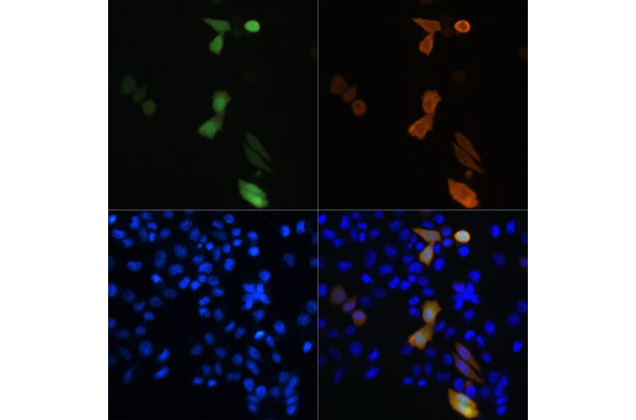 Immunofluorescence - Anti-DDDDK Tag Antibody [ARC5111-02] (A93056) - Antibodies.com