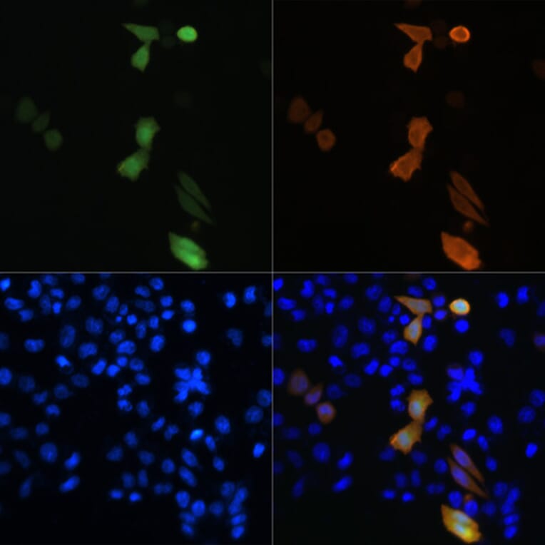Immunofluorescence - Anti-DDDDK Tag Antibody [ARC5111-02] (A93056) - Antibodies.com