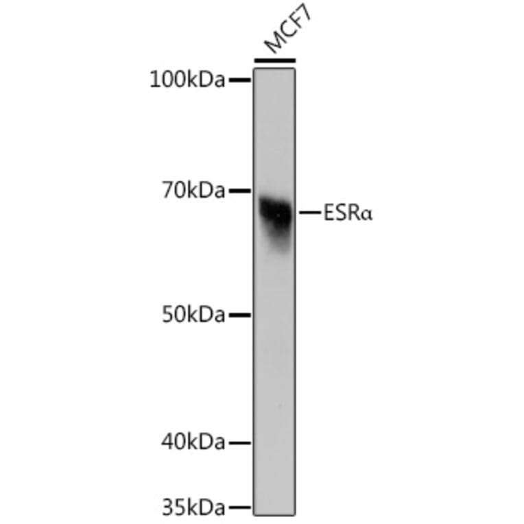 Western Blot - Anti-Estrogen Receptor alpha Antibody [ARC0199] (A93057) - Antibodies.com