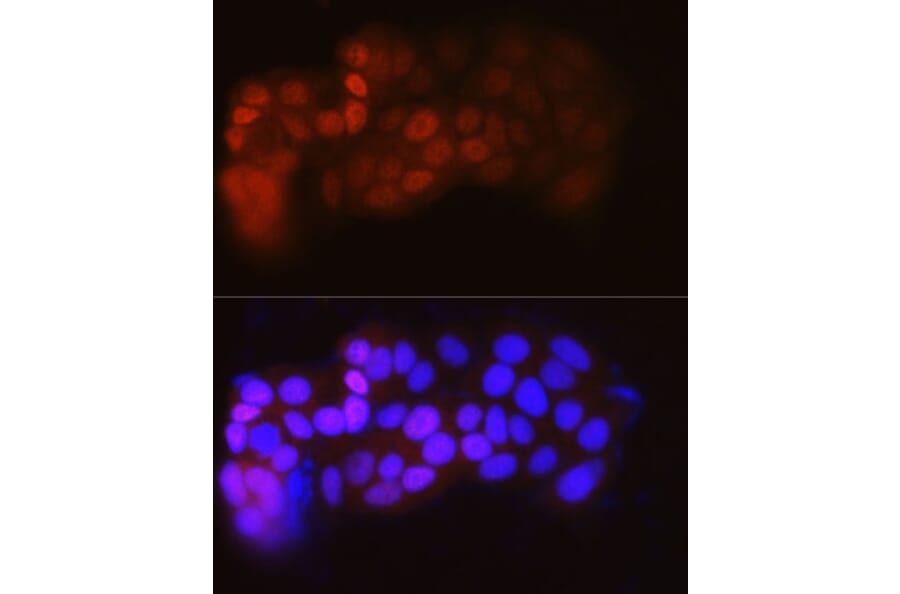 Immunofluorescence - Anti-Estrogen Receptor alpha Antibody [ARC0199] (A93057) - Antibodies.com